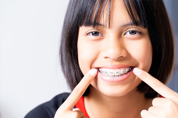 questions-about-invisalign-for-teens